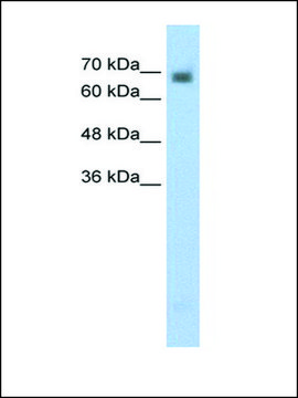 Anti-CRMP1 (AB1) antibody produced in rabbit affinity isolated antibody