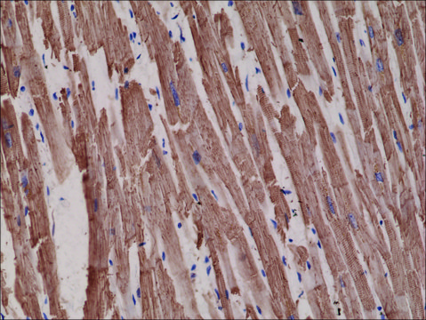 Anti-alpha-Cardiac Actin (ACTC1) antibody, Rabbit monoclonal recombinant, expressed in HEK 293 cells, clone RM257, purified immunoglobulin