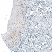 Anti-CERS3 antibody produced in rabbit Prestige Antibodies® Powered by Atlas Antibodies, affinity isolated antibody, buffered aqueous glycerol solution