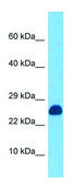 Anti-JCHAIN (N-terminal) antibody produced in rabbit affinity isolated antibody