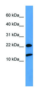 Anti-RPS27A antibody produced in rabbit affinity isolated antibody