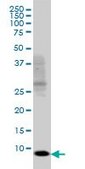 Monoclonal Anti-SH2D1A antibody produced in mouse clone 1C9, purified immunoglobulin, buffered aqueous solution