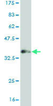 Monoclonal Anti-MUSK antibody produced in mouse clone 1F3, purified immunoglobulin, buffered aqueous solution