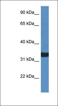 Anti-ACER1 antibody produced in rabbit affinity isolated antibody