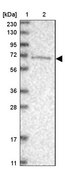 Anti-ANKRD44 antibody produced in rabbit Prestige Antibodies® Powered by Atlas Antibodies, affinity isolated antibody, buffered aqueous glycerol solution