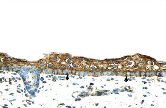 Anti-RBPMS antibody produced in rabbit affinity isolated antibody