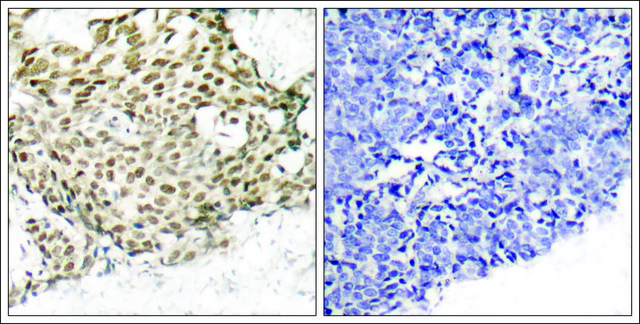 Anti-NBN (Ab-343) antibody produced in rabbit affinity isolated antibody