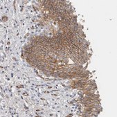 Anti-CD59 antibody produced in rabbit Prestige Antibodies® Powered by Atlas Antibodies, affinity isolated antibody, buffered aqueous glycerol solution