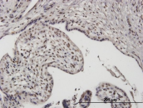 Monoclonal Anti-UBTF antibody produced in mouse clone 1A2, purified immunoglobulin, buffered aqueous solution