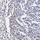 Anti-AKT1 antibody produced in rabbit