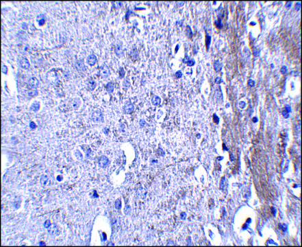 Anti-MATN4 antibody produced in rabbit affinity isolated antibody, buffered aqueous solution