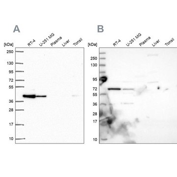 Anti-GIPC1 Prestige Antibodies&#174; Powered by Atlas Antibodies, affinity isolated antibody, buffered aqueous glycerol solution