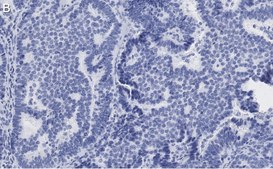 Anti-Beclin 1 Antibody, clone 1E22 , ZooMAb&#174; Rabbit Monoclonal recombinant, expressed in HEK 293 cells