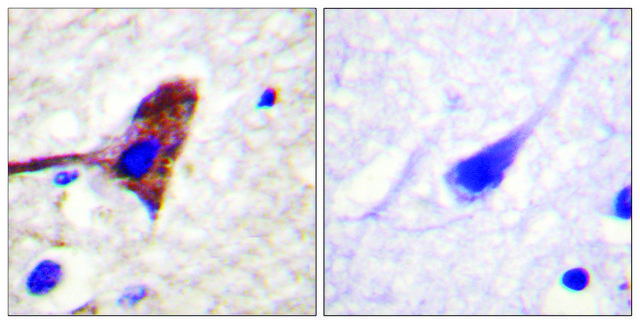 Anti-MTOR antibody produced in rabbit affinity isolated antibody