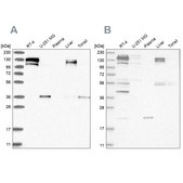 Anti-CGN antibody produced in rabbit Prestige Antibodies® Powered by Atlas Antibodies, affinity isolated antibody, buffered aqueous glycerol solution, ab3