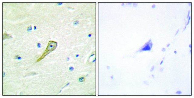 Anti-SEMA4A antibody produced in rabbit affinity isolated antibody