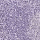 Anti-TMEM174 antibody produced in rabbit Prestige Antibodies® Powered by Atlas Antibodies, affinity isolated antibody, buffered aqueous glycerol solution