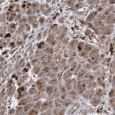 Anti-IL1RAPL2 antibody produced in rabbit Prestige Antibodies® Powered by Atlas Antibodies, affinity isolated antibody, buffered aqueous glycerol solution