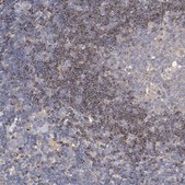 ANTI-SRRD antibody produced in rabbit Prestige Antibodies® Powered by Atlas Antibodies, affinity isolated antibody, buffered aqueous glycerol solution