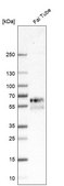 Anti-REC8 antibody produced in rabbit Prestige Antibodies® Powered by Atlas Antibodies, affinity isolated antibody, buffered aqueous glycerol solution