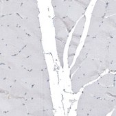 Anti-C1orf68 antibody produced in rabbit Prestige Antibodies® Powered by Atlas Antibodies, affinity isolated antibody, buffered aqueous glycerol solution