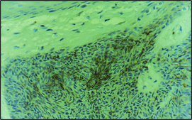 Monoclonal Anti-Cytokeratin Peptide 17 antibody produced in mouse clone CK-E3, ascites fluid