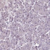 Anti-SLC26A9 antibody produced in rabbit Prestige Antibodies® Powered by Atlas Antibodies, affinity isolated antibody, buffered aqueous glycerol solution