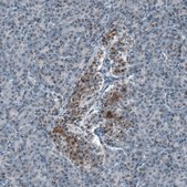 Anti-SCD5 antibody produced in rabbit Prestige Antibodies® Powered by Atlas Antibodies, affinity isolated antibody, buffered aqueous glycerol solution