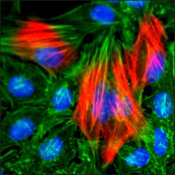 Anti-Calponin-1 antibody, Rabbit monoclonal recombinant, expressed in HEK 293 cells, clone RM262, purified immunoglobulin