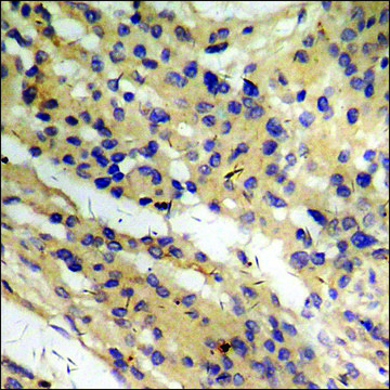 Anti-phospho-CD136/RON (pSer1394) antibody produced in rabbit affinity isolated antibody