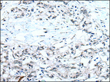 Anti-MTHFR affinity isolated antibody