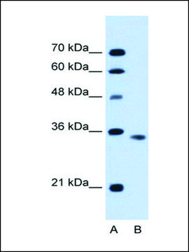 Anti-ACVR2B antibody produced in rabbit affinity isolated antibody