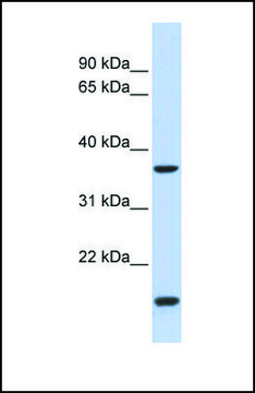 Anti-ZIC4, (N-terminal) antibody produced in rabbit affinity isolated antibody