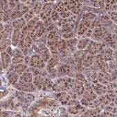 Anti-HPS3 antibody produced in rabbit Prestige Antibodies® Powered by Atlas Antibodies, affinity isolated antibody, buffered aqueous glycerol solution
