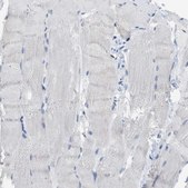 Anti-FAM208A antibody produced in rabbit Prestige Antibodies® Powered by Atlas Antibodies, affinity isolated antibody, buffered aqueous glycerol solution