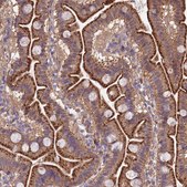 Anti-QRFP antibody produced in rabbit Prestige Antibodies® Powered by Atlas Antibodies, affinity isolated antibody, buffered aqueous glycerol solution