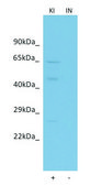 Anti-A4GALT antibody produced in rabbit affinity isolated antibody