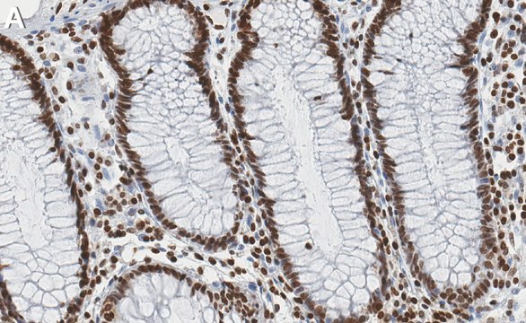 Anti-HMGA1 Antibody, clone 1F20 ZooMAb&#174; Rabbit Monoclonal recombinant, expressed in HEK 293 cells