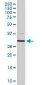 Monoclonal Anti-CDK4, (C-terminal) antibody produced in mouse clone 2G7, purified immunoglobulin, buffered aqueous solution
