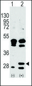 Anti-UBTD1 (C-term Q173) antibody produced in rabbit Ig fraction of antiserum, buffered aqueous solution