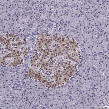 Anti-BCL7B antibody produced in rabbit Prestige Antibodies&#174; Powered by Atlas Antibodies, affinity isolated antibody, buffered aqueous glycerol solution