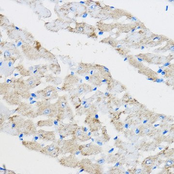 Anti-PPAR gamma antibody produced in rabbit