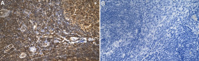 Anti-Profilin-1 Antibody, clone 1H21 ZooMAb&#174; Rabbit Monoclonal recombinant, expressed in HEK 293 cells