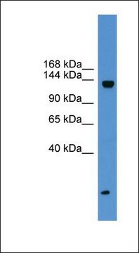 Anti-KIAA0999 antibody produced in rabbit affinity isolated antibody