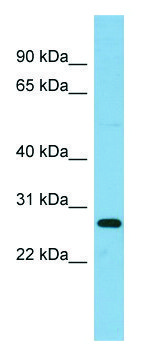 Anti-RPL10A antibody produced in rabbit affinity isolated antibody