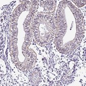 Anti-SMIM4 antibody produced in rabbit Prestige Antibodies® Powered by Atlas Antibodies, affinity isolated antibody, buffered aqueous glycerol solution