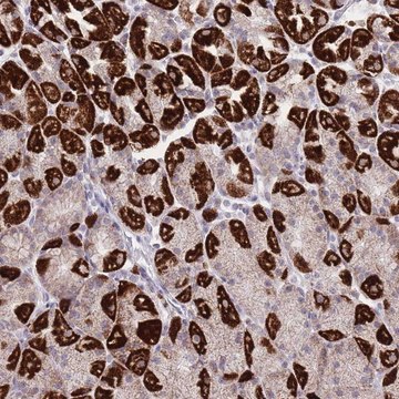 Anti-DENND2D antibody produced in rabbit Prestige Antibodies&#174; Powered by Atlas Antibodies, affinity isolated antibody, buffered aqueous glycerol solution