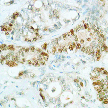 Anti-MSH6 antibody, Rabbit monoclonal clone SP93, recombinant, expressed in proprietary host, affinity isolated antibody