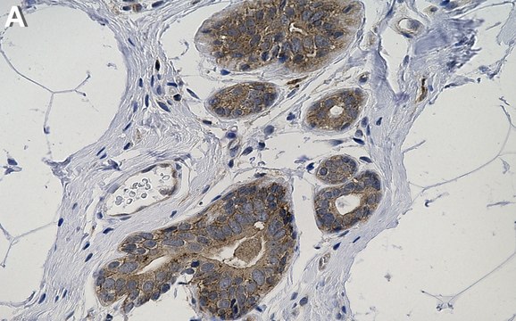 Anti-Chk1 Antibody, clone 2E14 ZooMAb&#174; Rabbit Monoclonal recombinant, expressed in HEK 293 cells