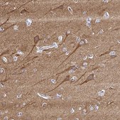 Anti-PPFIA4 antibody produced in rabbit Prestige Antibodies® Powered by Atlas Antibodies, affinity isolated antibody, buffered aqueous glycerol solution